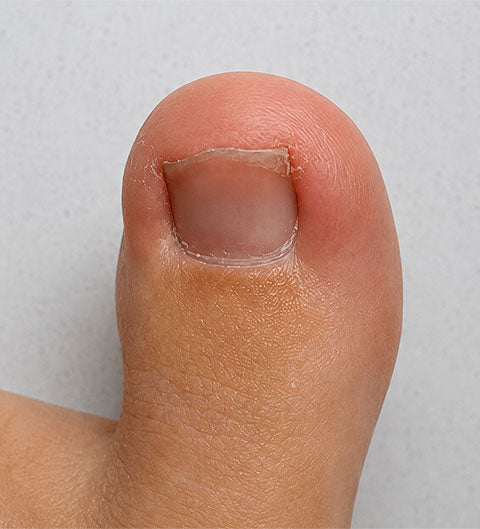 Mild Discomfort