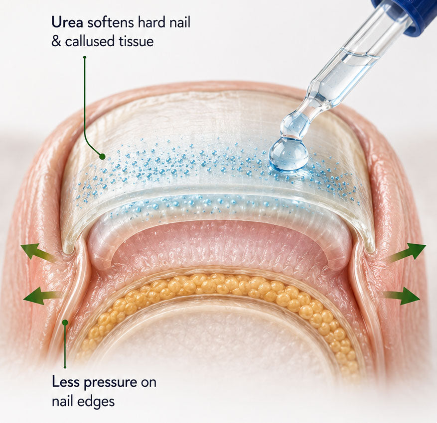 ClearZal softens old, thick nail