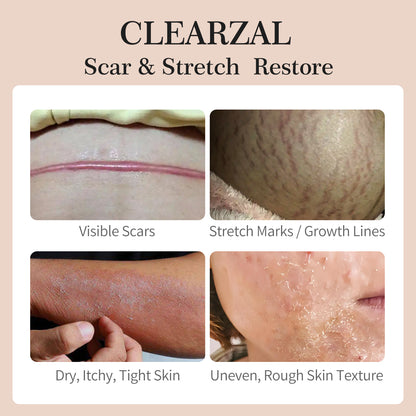 ClearZal® Anti-Aging Skin Serum