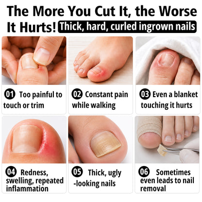 ClearZal® Nail Softener