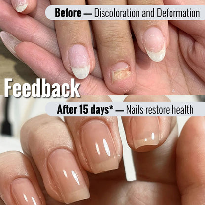 ClearZal® BAC Antimicrobial Nail Solution