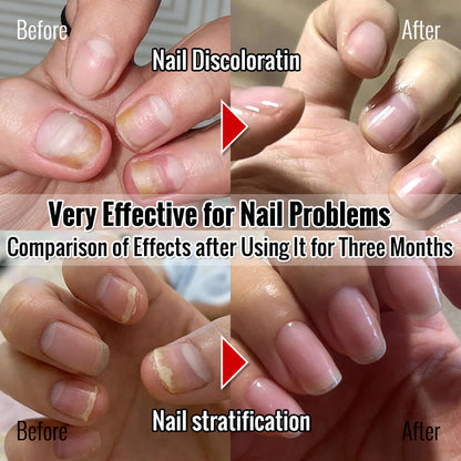 ClearZal® BAC Antimicrobial Nail Solution