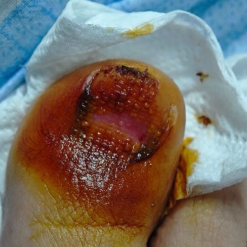 A Long, Difficult Recovery